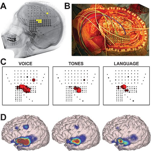 Human electrocorticographic brain signals illustration