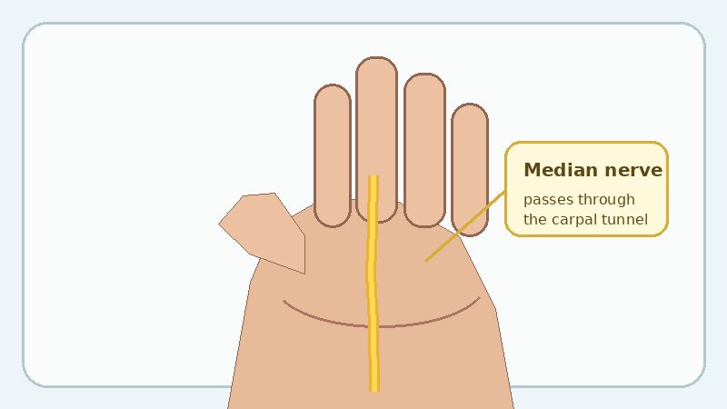 Illustration of a hand and the median nerve passing through the carpal tunnel