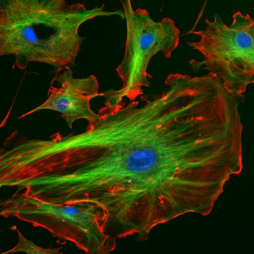 Fluorescence microscope image of cells with stained nuclei and cytoskeleton