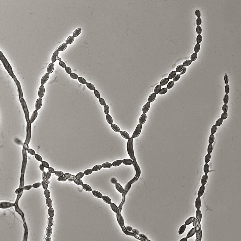 Microscope view of Cladophialophora bantiana mold showing branching chains of dark fungal cells