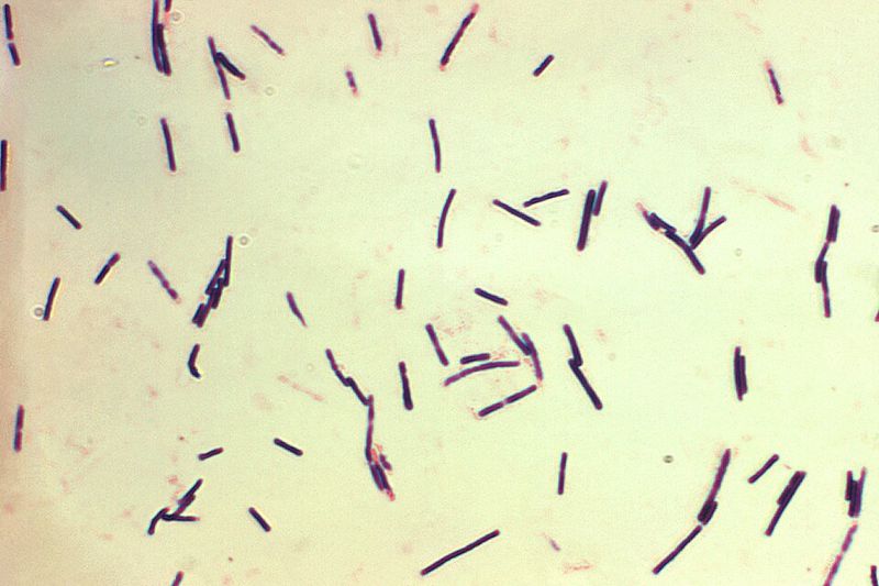 Rod-shaped Clostridium perfringens bacteria stained purple under a light microscope