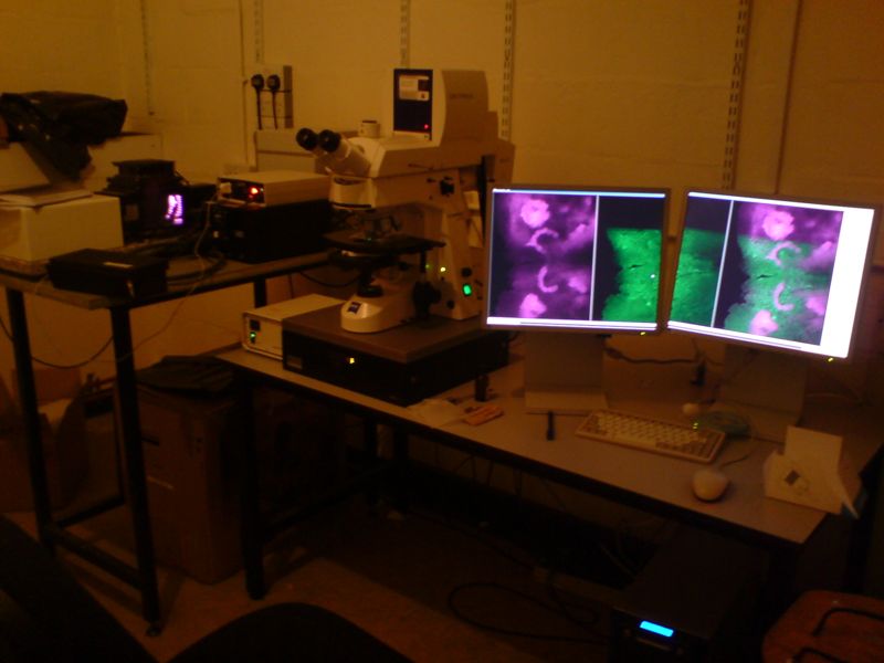 A laboratory confocal microscope beside two monitors showing colored cell images