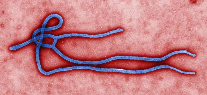 Colorized transmission electron micrograph of an Ebola virus particle