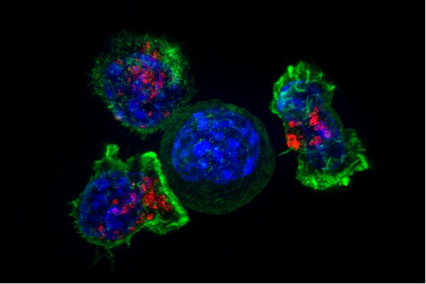 Fluorescent microscope image of killer T cells surrounding a cancer cell