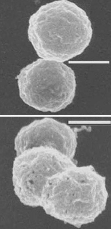 Scanning electron microscope images of round Halobacterium salinarum cells, a salt-loving archaeon whose cell wall is a glycoprotein S-layer