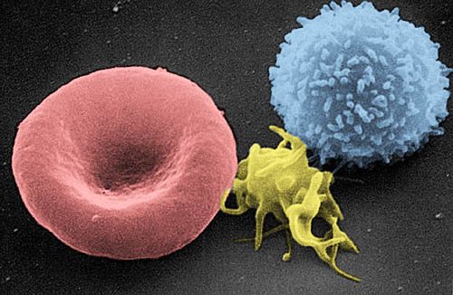 Scanning electron micrograph of human red blood cells, a platelet, and a white blood cell
