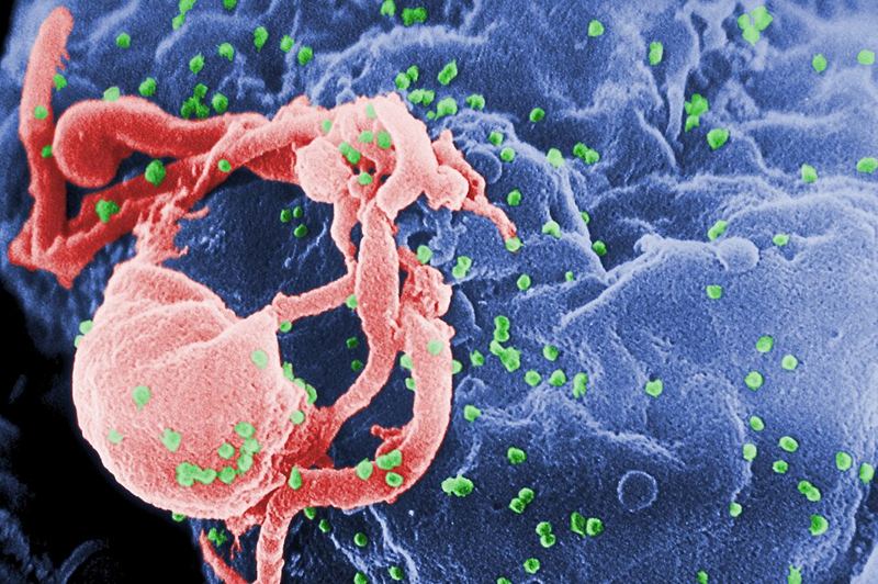 Colorized scanning electron micrograph of HIV-1 particles (green) budding from a lymphocyte