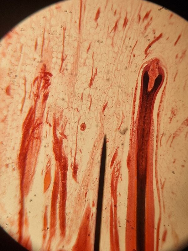 Stained microscope slide showing a hair follicle in cross section